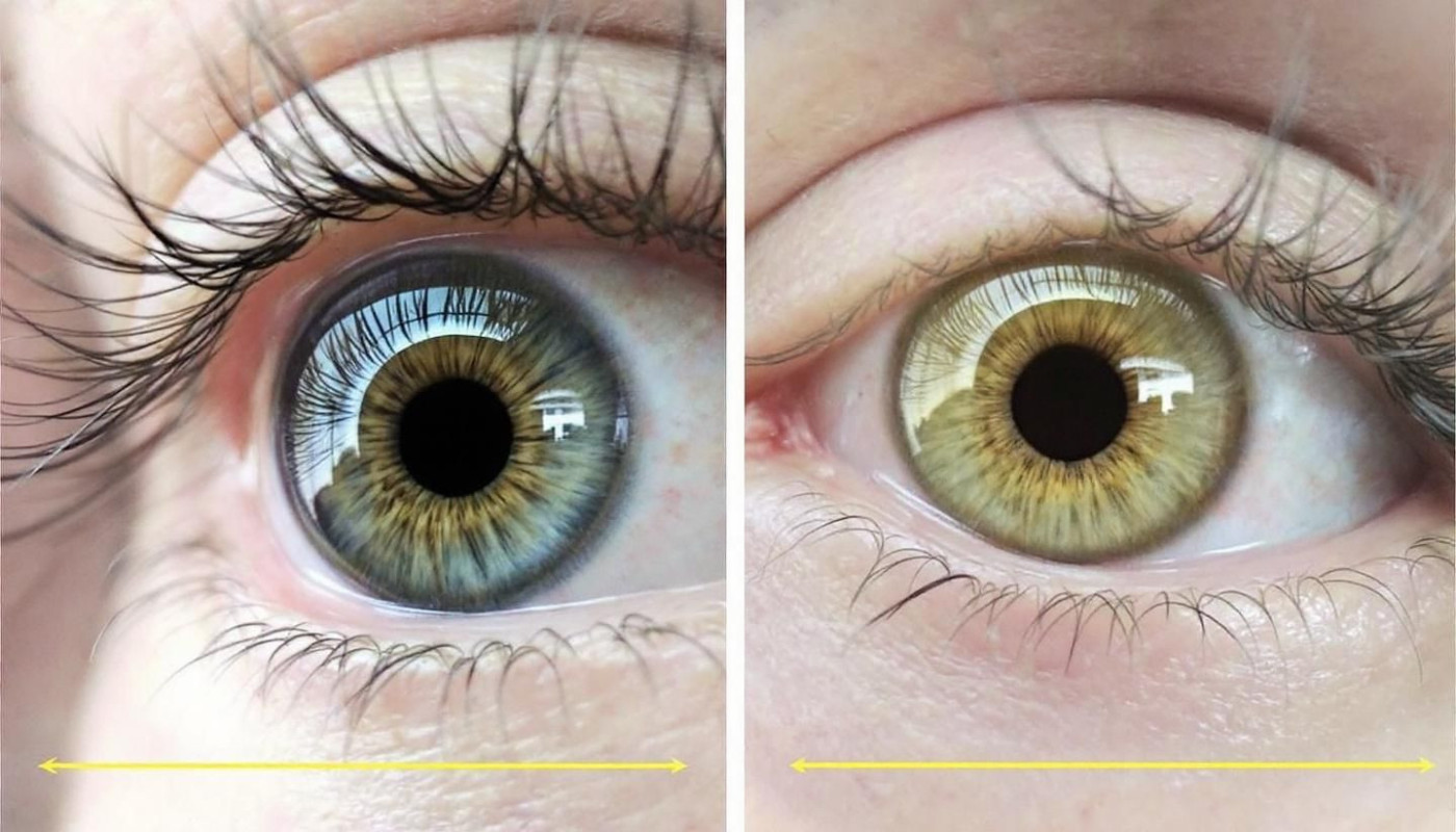 Comment choisir les meilleures lentilles de contact pour votre quotidien ?
